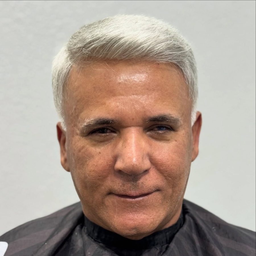 Resultado natural de prótese capilar grisalha de frente