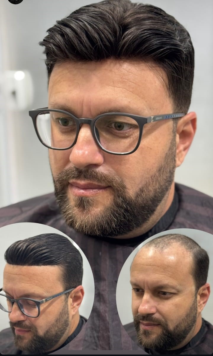 Homem ativo com prótese capilar treinando