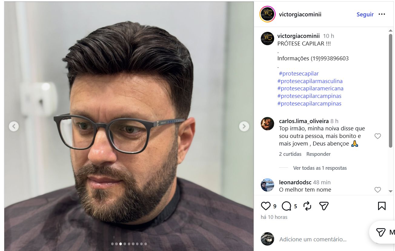 Depoimento real de cliente após prótese capilar com resultado natural
